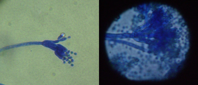 Microbiological study of cannabis samples