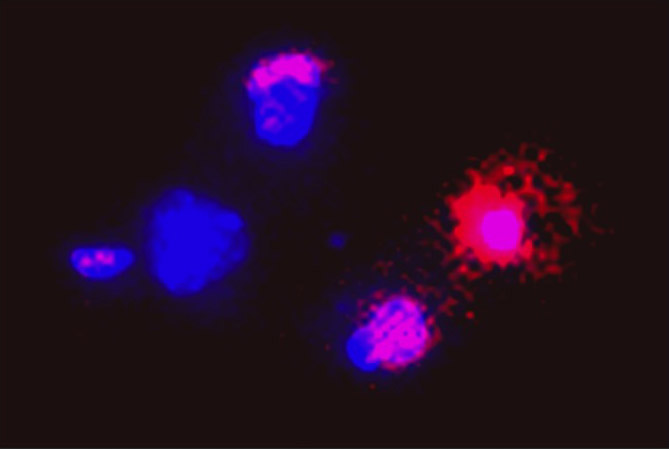 El sistema endocannabinoide cerebral en la enfermedad de Alzheimer