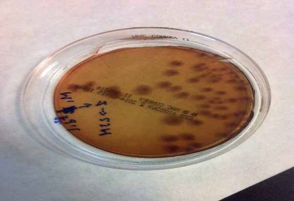 Microbiological study and quantification of cannabinoids