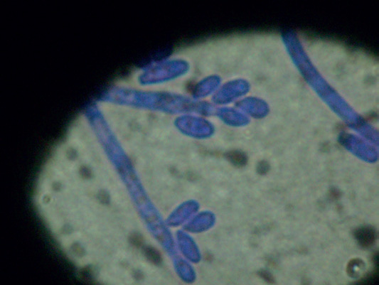 Estudi microbiològic i quantificació de cannabinoides