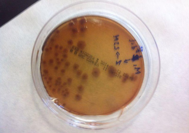 Microbiological study of cannabis samples