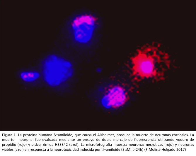 El sistema endocannabinoide cerebral en la enfermedad de Alzheimer