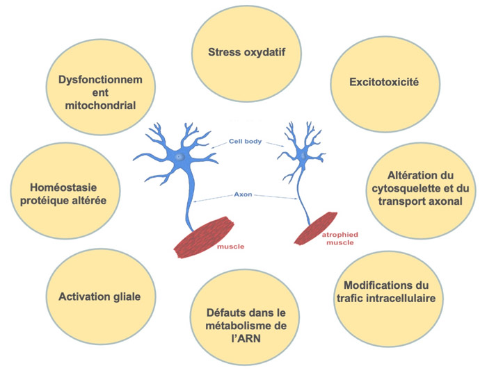 Terapias basadas en cannabinoides para la esclerosis lateral amiotrófica: una oportunidad en marcha