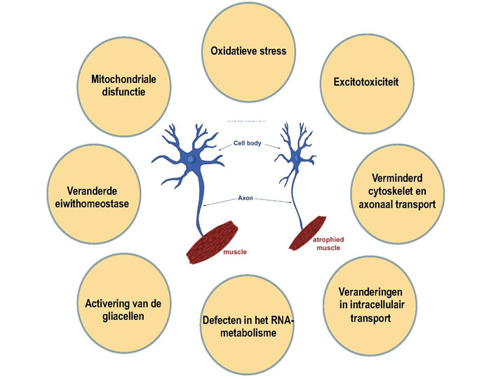 Terapias basadas en cannabinoides para la esclerosis lateral amiotrófica: una oportunidad en marcha